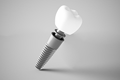 Dental implant