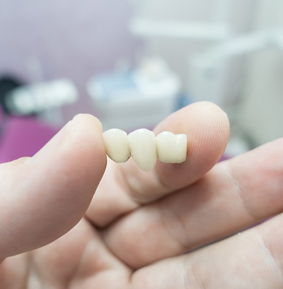 There are two types of dental bridges
