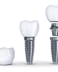 dental implant crown, abutment, and post