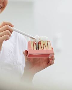 dentist holding a model of a dental implant in the jaw