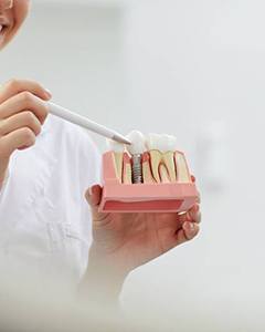 dentist holding a model of a dental implant in the jaw