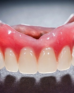 Image of an upper denture