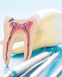 a tooth model showing root canals