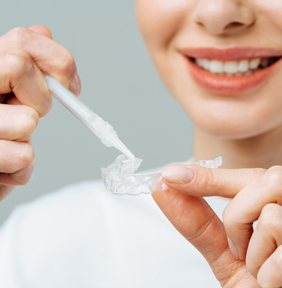 Woman using a take home teeth whitening kit