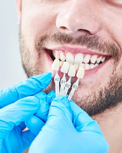 Man at consultation for veneers