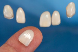 porcelain veneers in Allentown