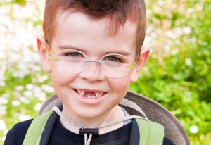 boy smiling with missing teeth