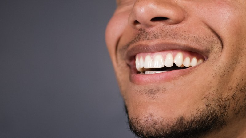 Man smiling after fluoride treatment